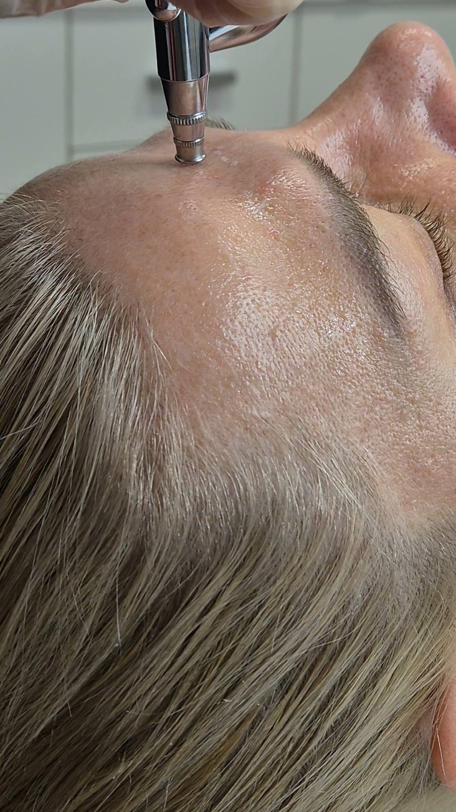 Intraceuticals - кислородна хидратация — снимка 5 от 7