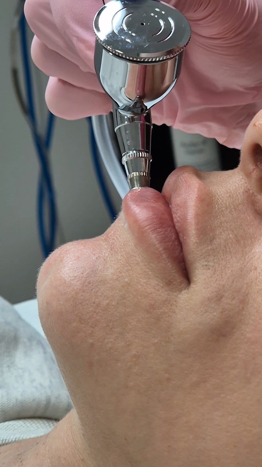 Intraceuticals - кислородна хидратация — снимка 6 от 7
